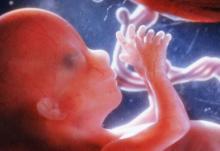 حمله میگرن در باردارى/ مسمومیت حاملگی کدام زنان را تهدید می‌کند؟ 